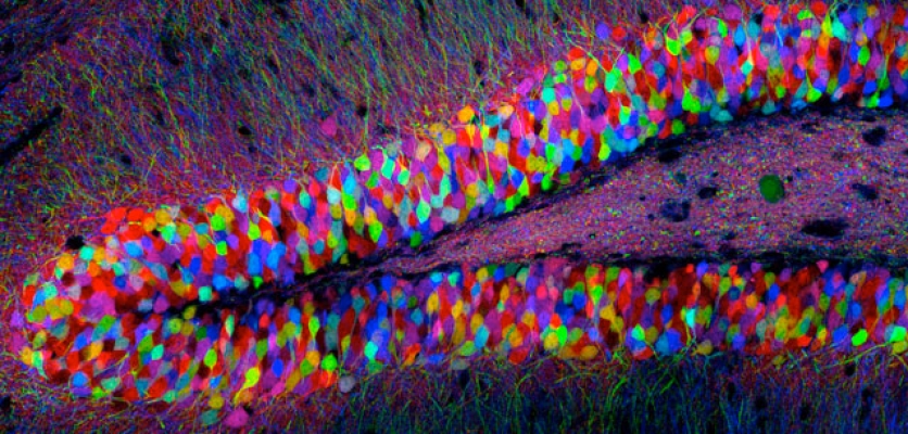 Researchers show that memories reside in specific brain cells