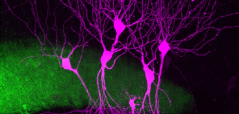 Discovering hippocampal connections responsible for episodic memory