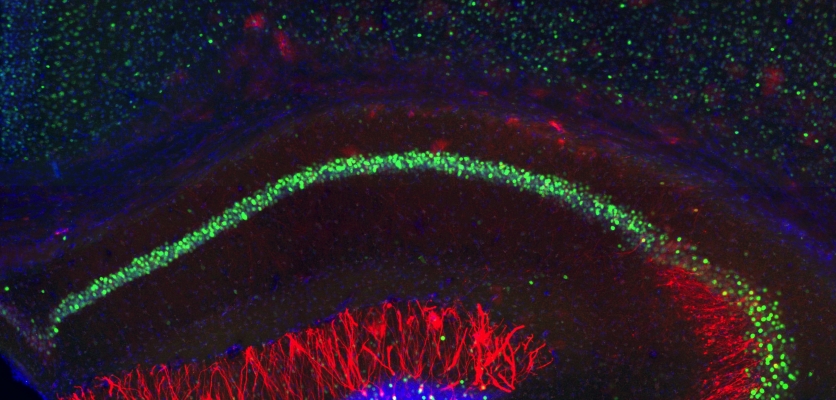 Neuroscientists plant false memories in the brain